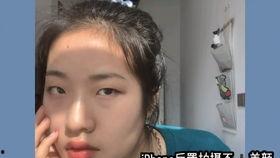内双肿眼泡明星网红,揭秘网红眼妆的秘密武器